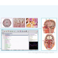 전신 건강 분석기 기계 biofeedback 사냥꾼 4025